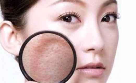毛孔粗大用食盐有用吗 毛孔粗大敷什么面膜好 毛孔粗大用食盐有用吗 毛孔粗大敷什么面膜好