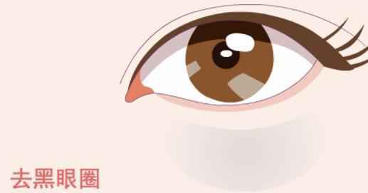 如何消除黑眼圈 黑眼圈很重是什么原因
