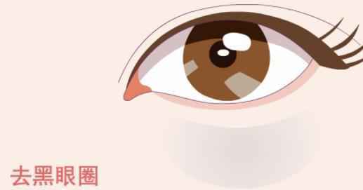 如何消除黑眼圈 黑眼圈很重是什么原因 如何消除黑眼圈 黑眼圈很重是什么原因