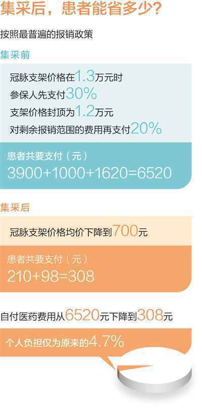 集中采购,心脏支架降价惠民(深度观察)