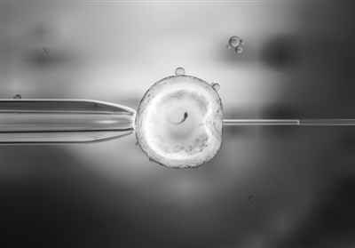 宝宝一出生就27岁 冷冻胚胎技术是如何做到的