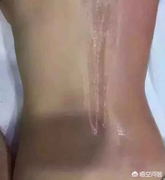 中医养生好还是美容养生保健好中医保健?