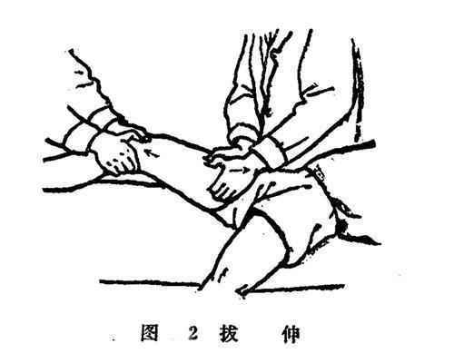 推拿师如何进行接骨复位呢?学会这8种手法推拿8,骨折伤痛轻松调理