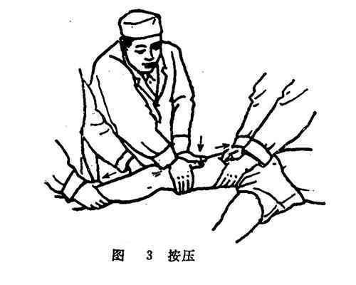 推拿师如何进行接骨复位呢?学会这8种手法推拿8,骨折伤痛轻松调理