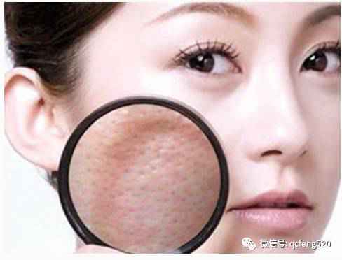 常见的肌肤问题?肌肤护理