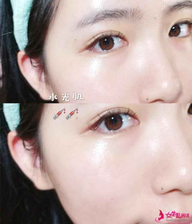 如何判断自己是“奶油肌”还是“水光肌”?主要看这几个部位!