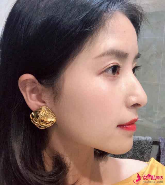 如何判断自己是“奶油肌”还是“水光肌”?主要看这几个部位!