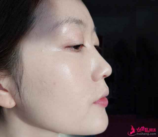 如何判断自己是“奶油肌”还是“水光肌”?主要看这几个部位!