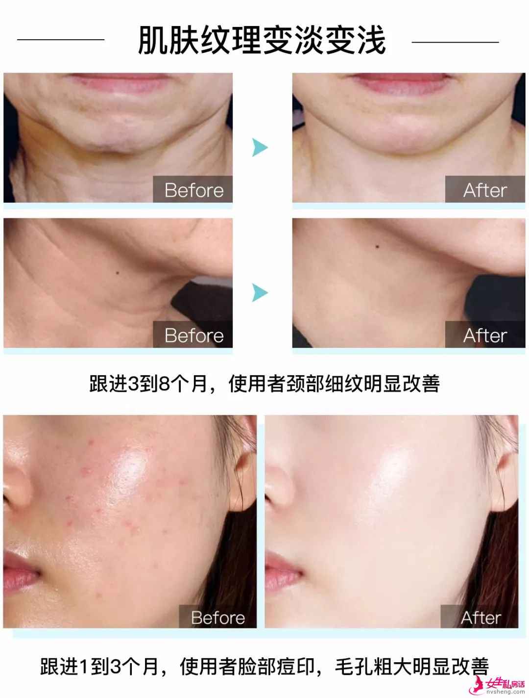 60 后和 90 后的颜值对比,五十几岁竟然也没输?!