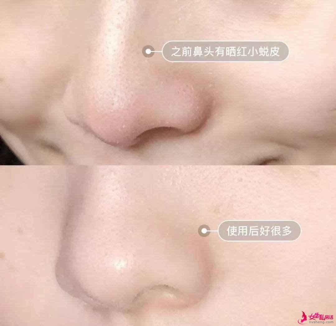 晒后别慌,稳住皮肤,我们能赢!