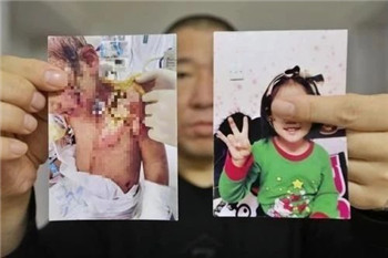 007 亲爸绑架?亲妈开水浇头?请别用孩子做你失败婚姻的撒气桶