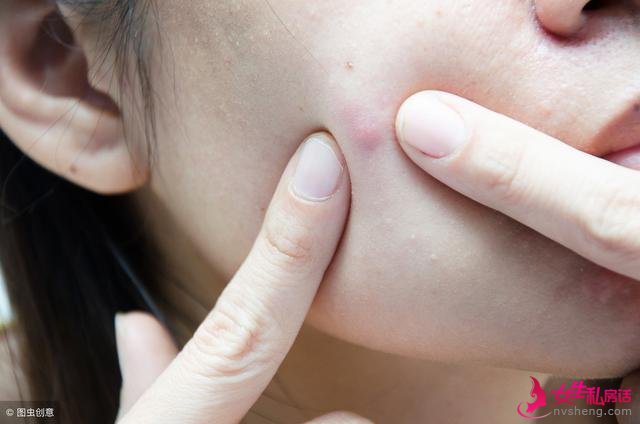 每每得皮肤病?那都是由于肥胖惹起的肥胖容易惹起以下几种疾病