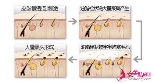 出油、毛孔粗大、黑头……解决这些皮肤难题的方法在这