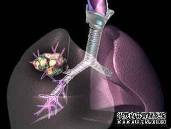 难得一见:中国顶级癌症专家盘点肺癌、乳腺癌、血液肿瘤治疗进展